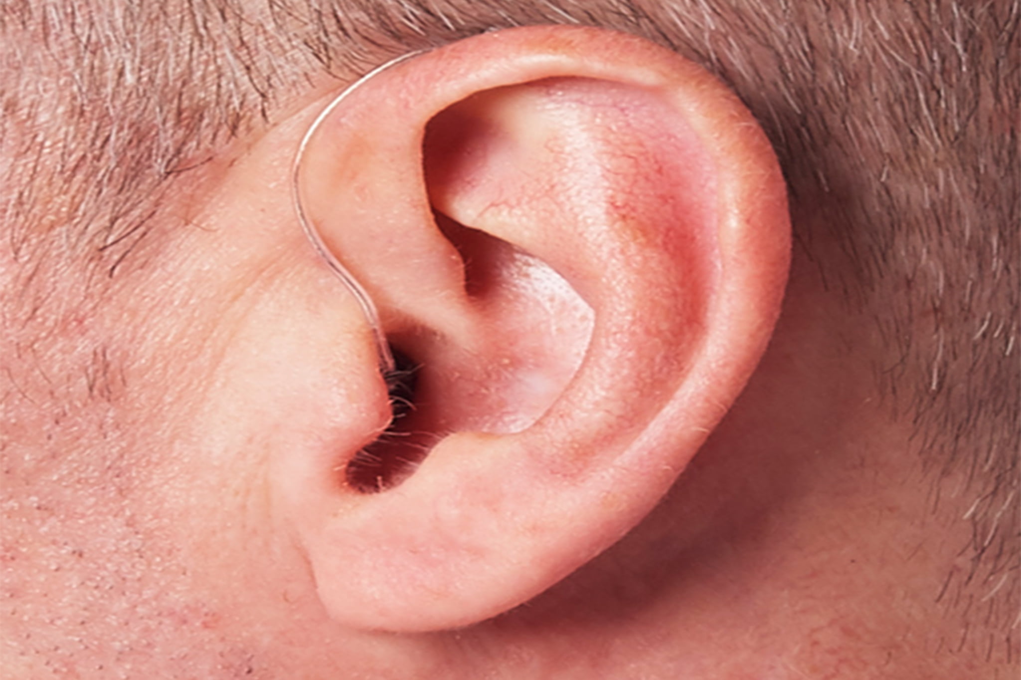 Receiver in the Ear